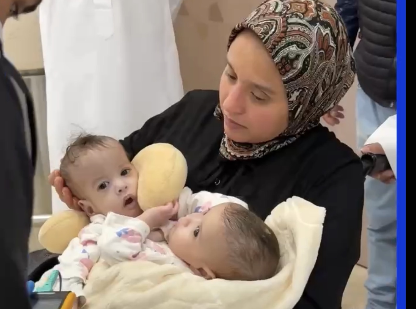 اليوم الخميس.. انطلاق عملية فصل التوأم المغربي الملتصق سجى وضحى في السعودية